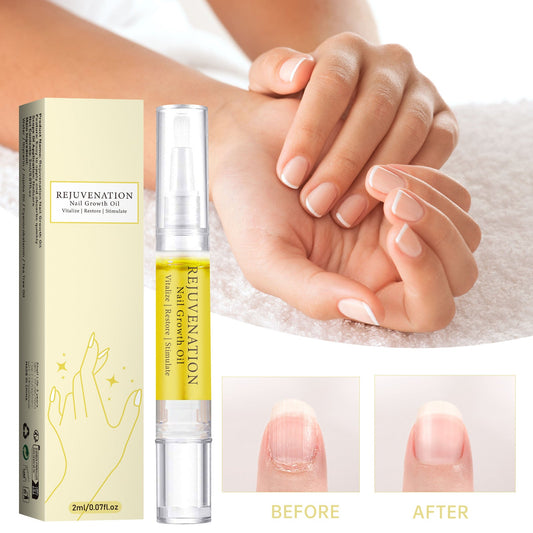 Nail Growth Oil-Fingertip beauty